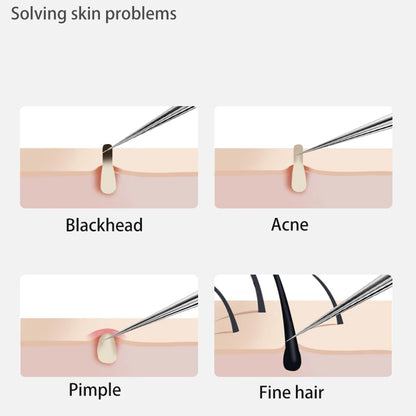 ZitZero's Proffesional Acne Removers